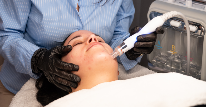 Hydrafacial-Deluxe-Behandlung und Tiefenreinigung für einen strahlenden Teint bei Bahia Beauty Brasil.